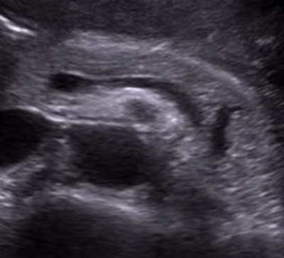 Private pancreas ultrasound