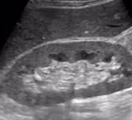 Private Kidney Ultrasound